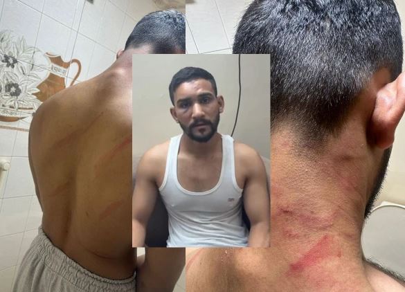 کراچی میں پولیس اہلکاروں کا رشوت نہ دینے پر شہری پر بہیمانہ تشدد